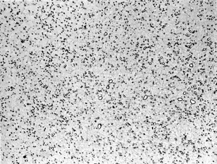 ASTM Sphericity