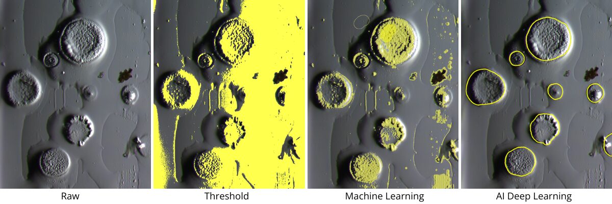 AI-powered Deep Learning for Dic Water Droplets