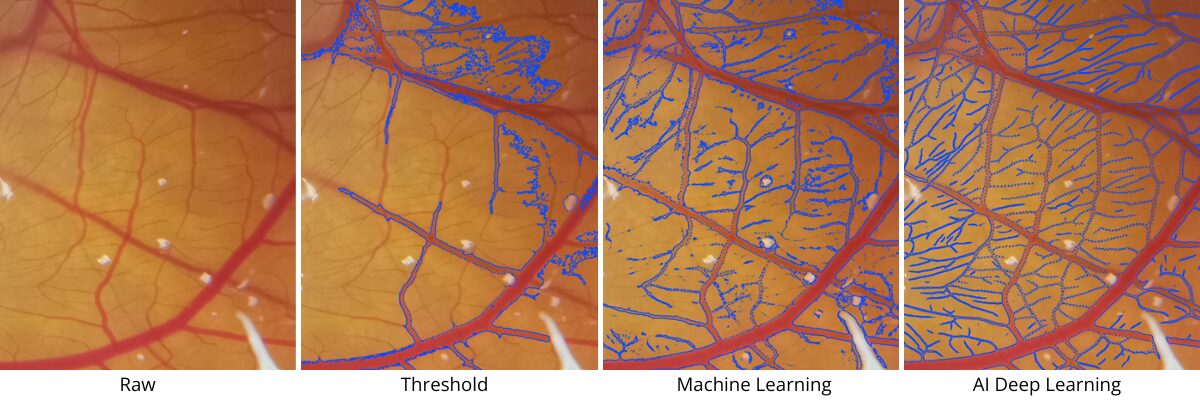 AI-powered Deep Learning for Vessel Segmentation