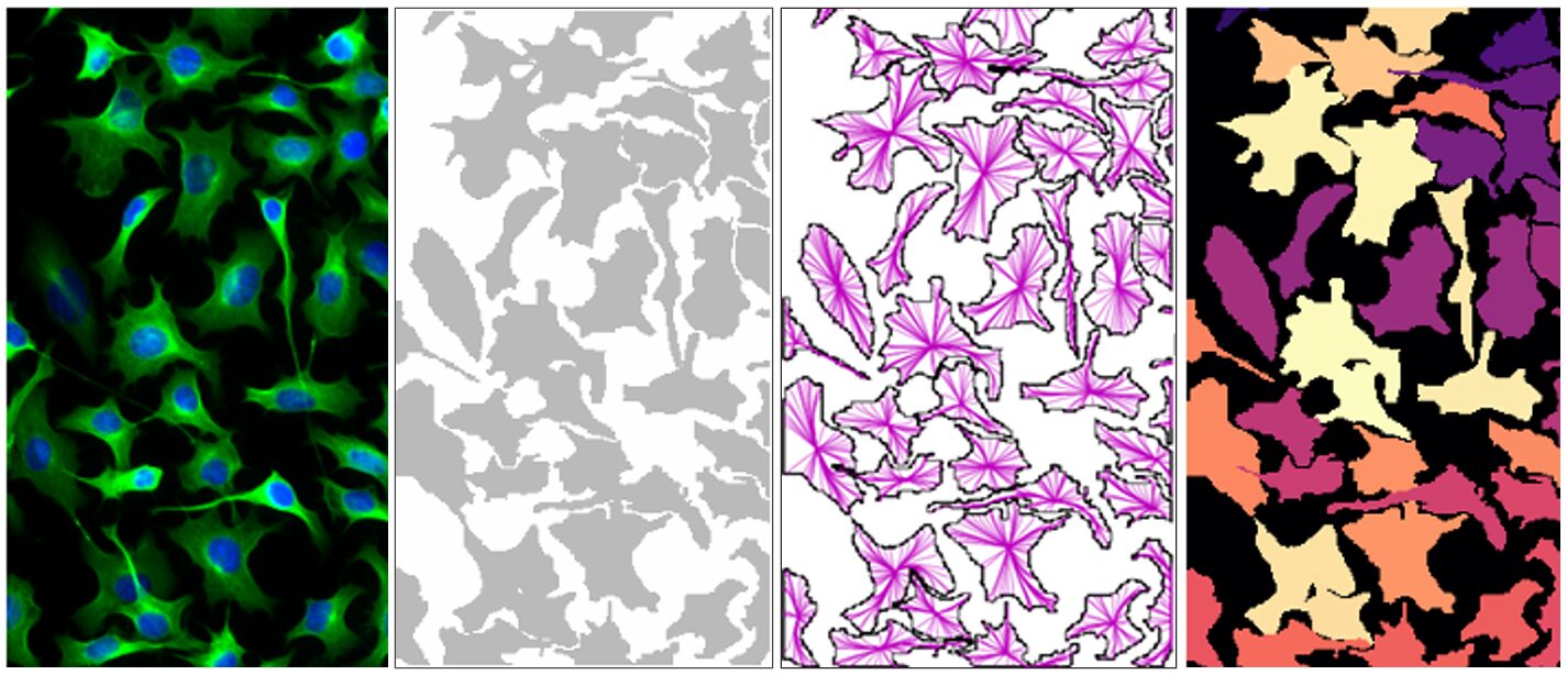 Instance Segmentation of individual cell using Cellpose-base Model