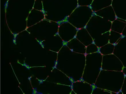 Angiogenesis
