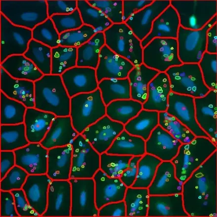 Cell Autophagy