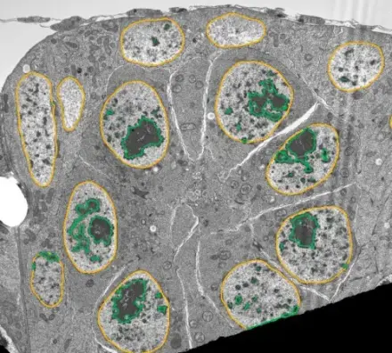 Nuclei & Chromatin