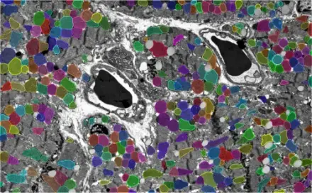 Mitochondria