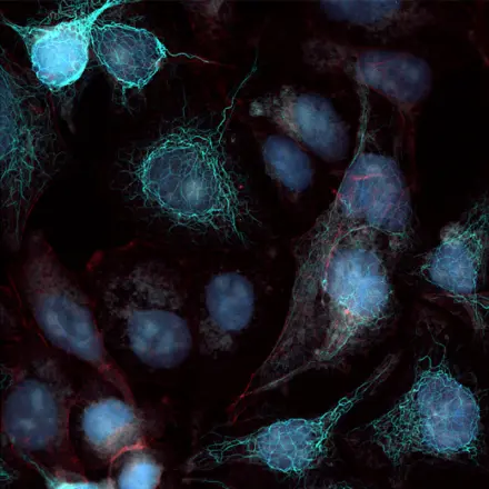 Real-Time Deconvolution