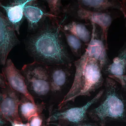 Real-Time Deconvolution