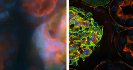 AutoQuant Deconvolution