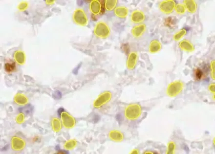 Stained Tissues And Colonies
