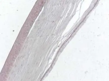 Eye-Section-detail