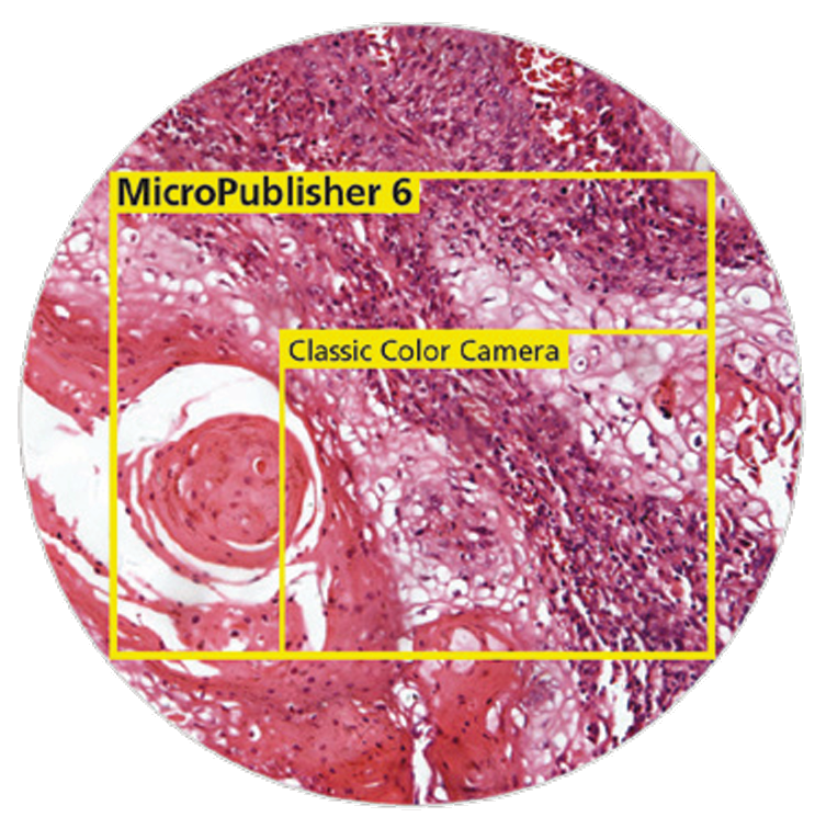 MicroPublisher 6 FieldOfView